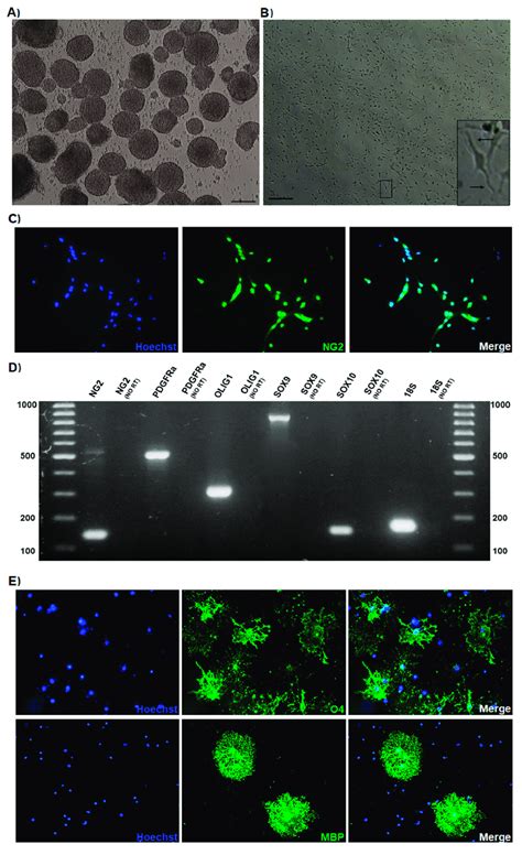 Oligodendroglial Progenitor Cells Opc Cultures Derived From The