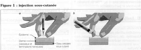 Injection Sous Cutanée ·