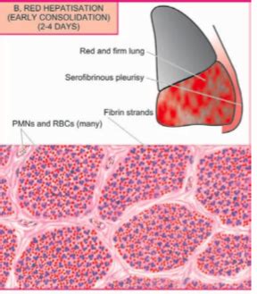 Pathology Of Inflammatory Responses Flashcards Quizlet