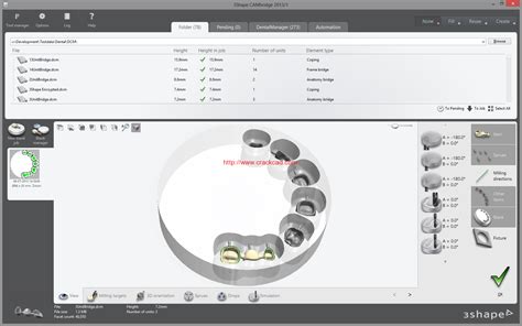 3shape Dental System 2019 Dental System Software Trainingtutorials