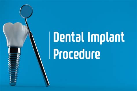 How Two Stage Dental Implants Are Performed Your General Dentist In