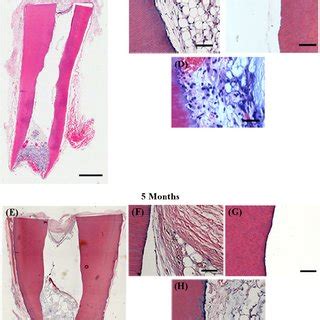 empty tooth root constructs remain empty     month