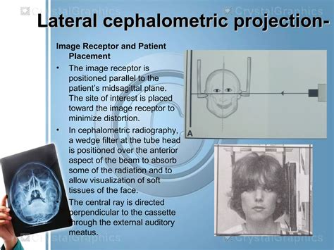 Extraoral Radiography Ppt