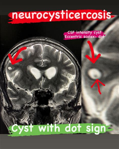 Matrix Case 355: -... - Radiology Matrix - medical education