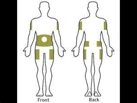 Insulin Injection Site Rotation Youtube