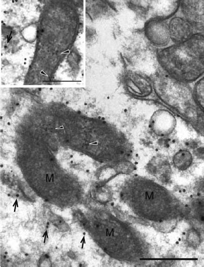 Double Immunogold Labeling Of Sections Obtained From The Substantia