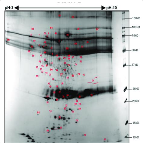 Annotated Proteins In The Fraction After 20 Ammonium Sulphate Download Scientific Diagram