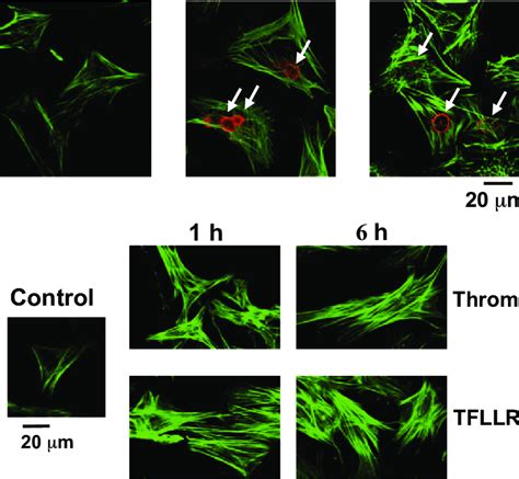 Morphological Changes In Cultured Neonatal Rat Ventricular Myocytes