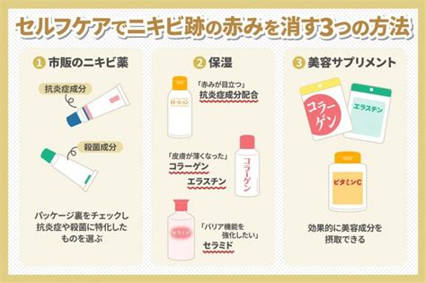 ニキビ跡の赤みを消すには？肌のお悩みを解決！ 共立美容外科【公式コラム】｜美容整形、美容医療専門クリニック