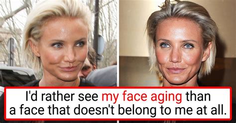 8 Celebrities Who Tried Cosmetic Surgery Once and Said “Never Again ...