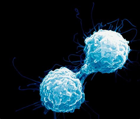 Alpine Immune Sciences Raises 48m For Immunotherapy