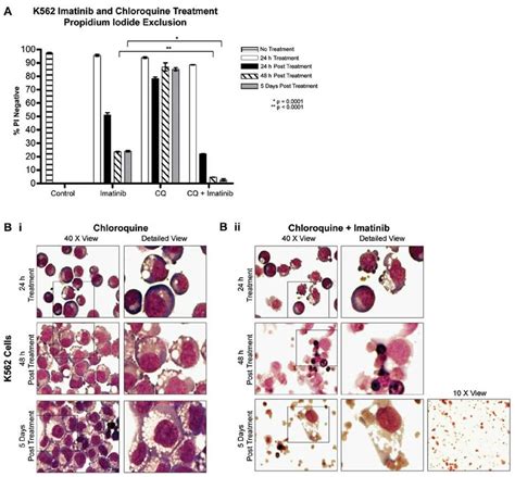 Effects Of The Combination Of Chloroquine And Imatinib On Cell