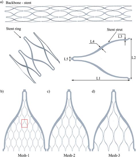 ThinFilm PatientSpecific Flow Diverter Stents For The Treatment Of