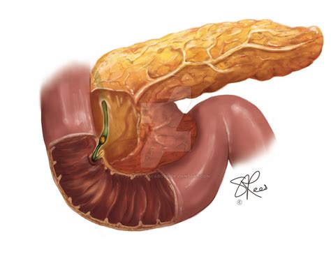 Inflamed Pancreas by cheery-macaroon on DeviantArt