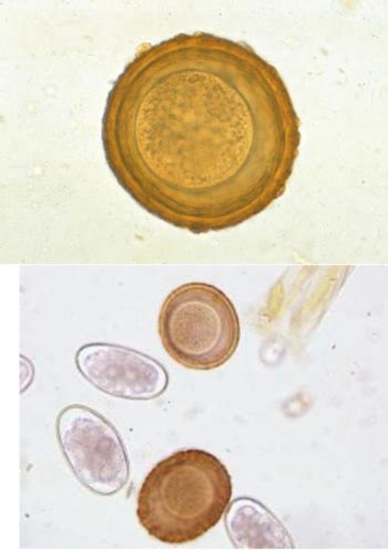 Nematodes Id Flashcards Quizlet