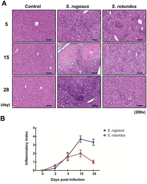 A Histopathology Of Mice Liver Infected With Segniliparus Spp At 5