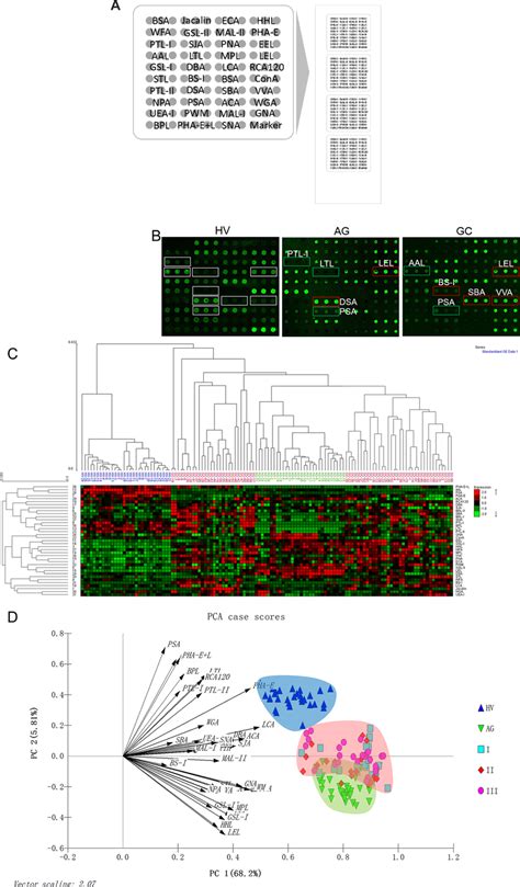 The Different Salivary Glycopatterns In Patients With Gc Or Ag And In