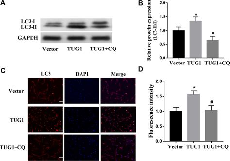 Involvement Of The Autophagy Pathway In The Tug1 Mediated Effects On