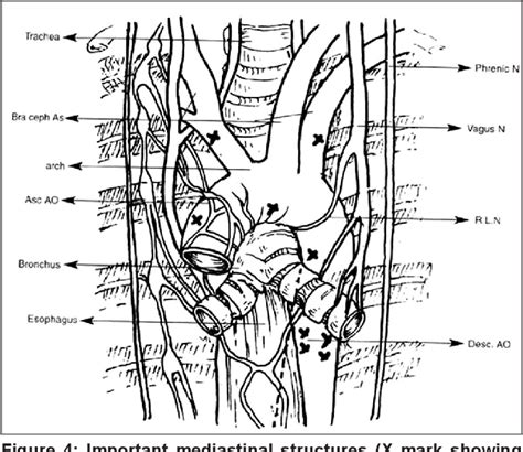 Figure From Management Of Ventricular Septal Defect With Pulmonary