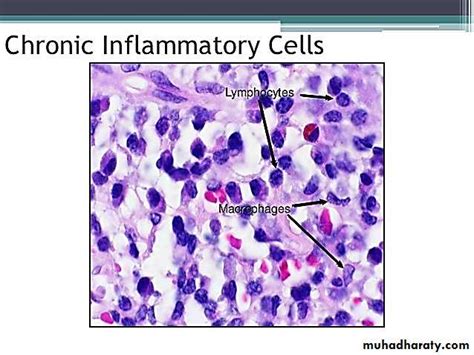 Acute Inflammation Pptx Muhadharaty