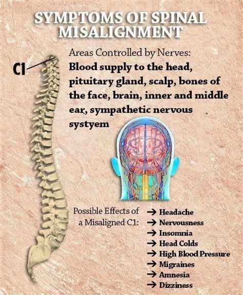 Symptoms of Spinal Misalignment | Chiropractic, Chiropractic therapy ...