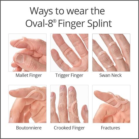 Pp Oval Finger Splints Graduated Set Of Stabilize Finger Joints