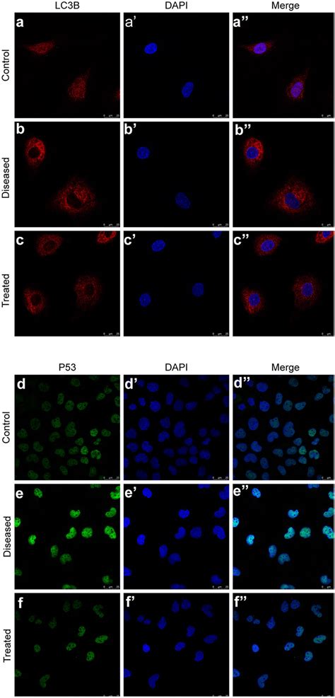 Esomeprazole Suppresses Autophagy In Htr Svneo Cells Treated With