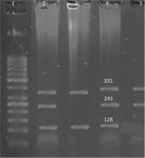 SNP Rs3780135 Well 1 Indicates The DNA Ladder 50 Bp An Amplicon