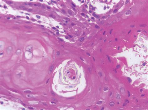 Photomicrograph Showing Hematoxylin And Eosin Section Of Download Scientific Diagram