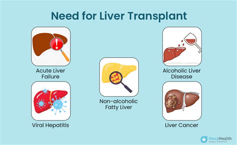 A Simple Guide To Liver Transplant Procedure At Hexahealth