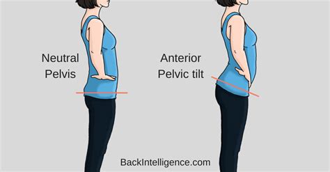 How To Fix Anterior Pelvic Tilt Posture 10 Exercises Back Intelligence