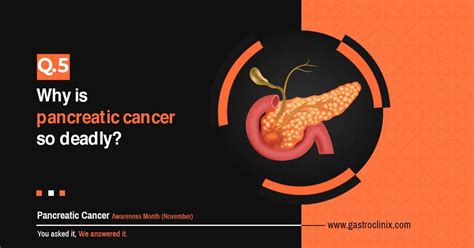 Pancreatic Cancer Frequently Asked Questions Part Dr Harsh J Shah