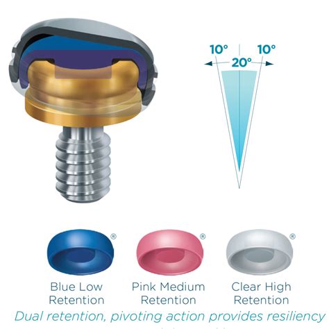 Zest Locator Abutments and Overdentures at RDL | Russellville Dental Lab