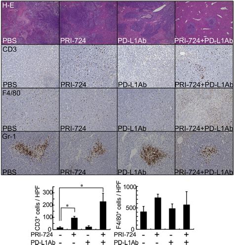 CBP β catenin inhibition increased lymphocyte infiltration to