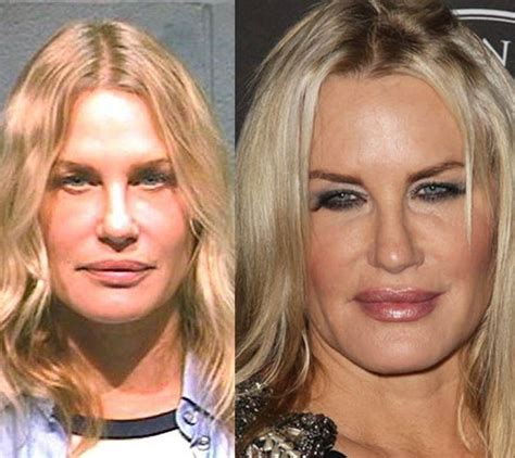 Daryl Hannah Before And After Plastic Surgery 02 Celebrity Plastic