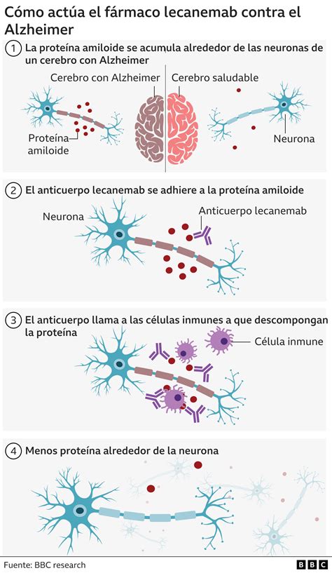 Alzheimer Lecanemab El Medicamento Aclamado Como Un Avance