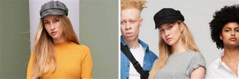 Primark Features Models With Limb Difference Albinism In New Campaign