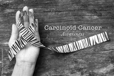 Carcinoid Cancer Awareness Ribbon Zebra Stripe Pattern On Helping Hand