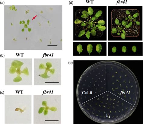 Isolation Phenotypic And Genotypic Characterization Of Fumonisin B1