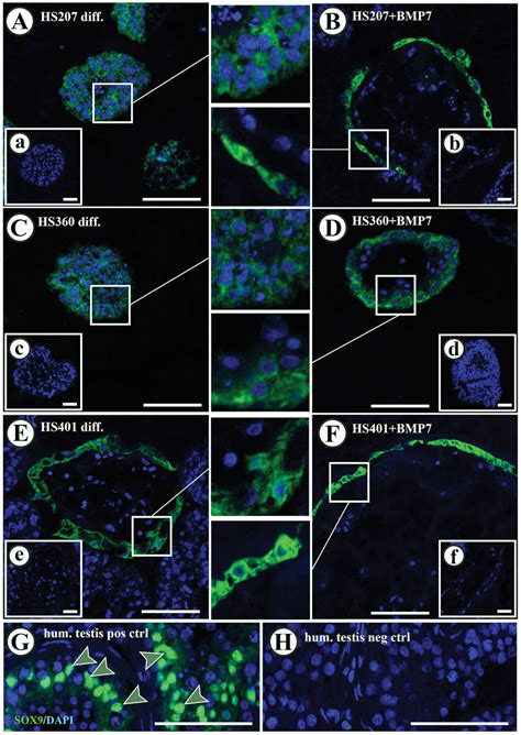 Immunofluorescence Detection Of Sox In Hs Hs And Hs Cells