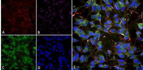 Anti Vglut Transporter Antibody Qed Bioscience Inc