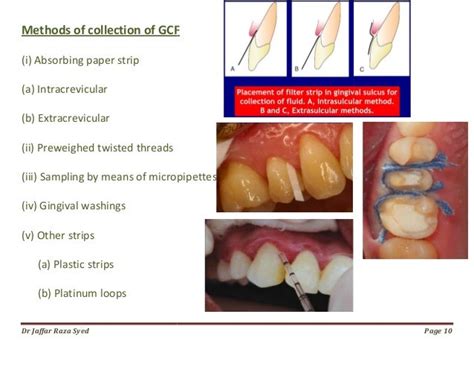 018defense Mechanisms Of Gingiva