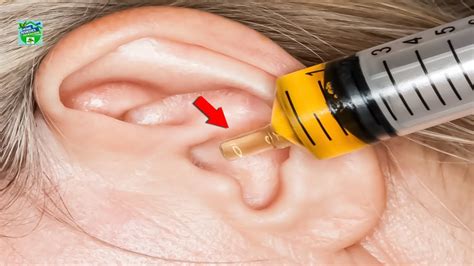 How To Make And Use Garlic Oil Ear Drops Youtube