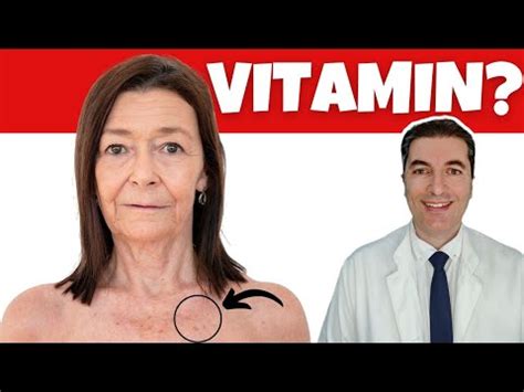 Br Vitamin Za Uklanjanje Stara Kih Mrlja Youtube