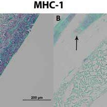 MHC 1 Staining Prior To A And After Decellularization B Showing