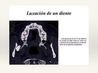 Tomografia De Haz Conico Cone Beam En Odontologia Ppt