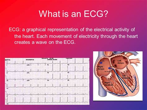 The T-Wave Explained What Do T Waves On An ECG Represent?, 55% OFF