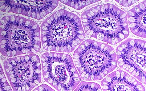 Small Intestine Cells Light Micrograph Bild Kaufen