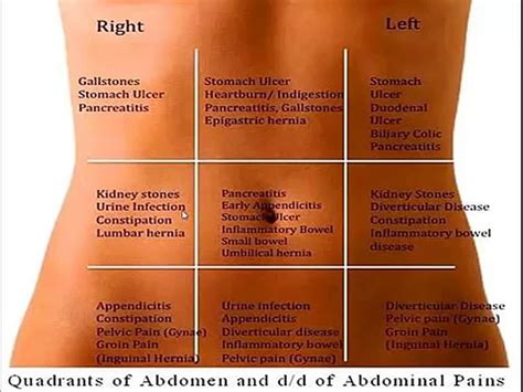 Differential Diagnosis Abdominal Pain