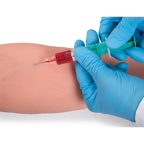 Iv Injection Sites Diagram Arm